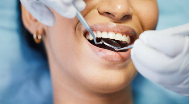 Best Emergency Wisdom Tooth Extraction in Great Notch, NJ